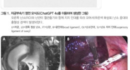 영상의학과 의사가 반드시 알아야 할 자궁부속기 염전 소견